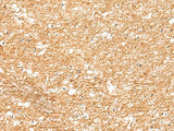 Immunohistochemistry of paraffin-embedded Human brain tissue using ZNF185 Polyclonal Antibody at dilution of 1:25(×200)