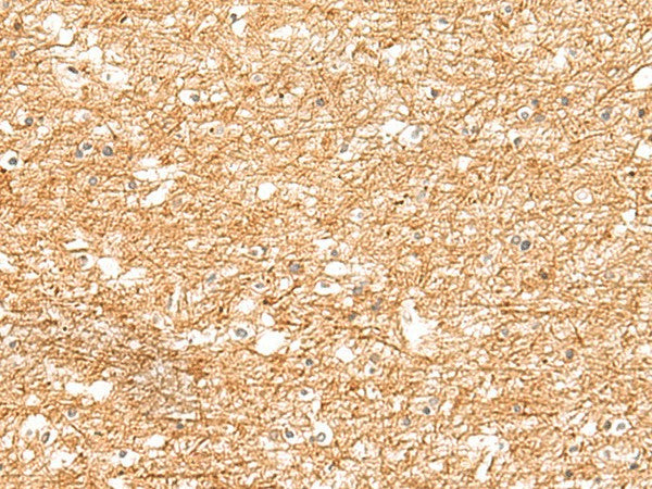 Immunohistochemistry of paraffin-embedded Human brain tissue using ZNF185 Polyclonal Antibody at dilution of 1:25(×200)