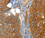 Anti-Human VWA5A Antibody - ABMIUM