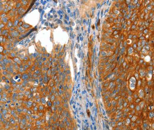 Anti-Human VWA5A Antibody