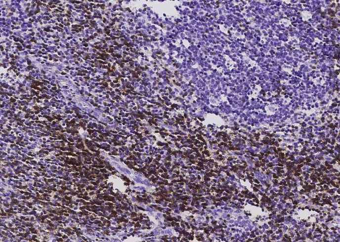 Anti-Human CD3D & CD3E Antibody [B529] - ABMIUM