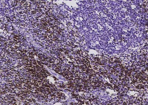 Anti-Human CD3D & CD3E Antibody [B529] - ABMIUM