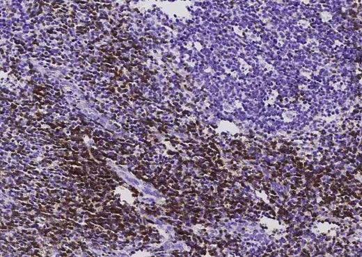 Anti-Human CD3D & CD3E Antibody [B529] - ABMIUM
