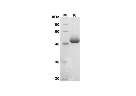 SDS-PAGE analysis of Mouse ACPP proteins, 2 μg/lane of Recombinant Mouse ACPP proteins was resolved with SDS-PAGE under reducing conditions, showing bands at 43 kDa.