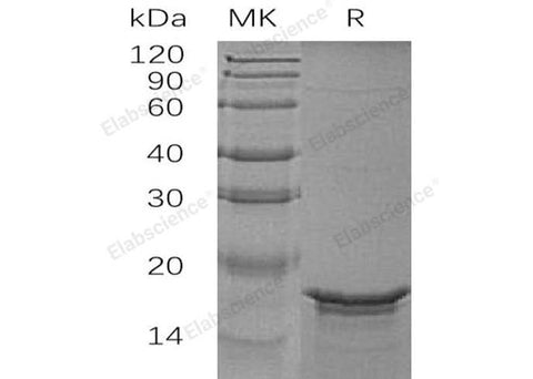 Recombinant Human GFAP Protein (His Tag) - ABMIUM