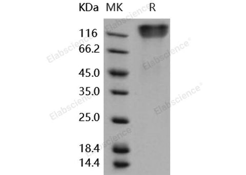 Recombinant Human OMGP/OMG Protein (aa 1-416, His Tag) - ABMIUM