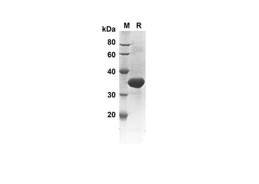 SDS-PAGE analysis of Human CASP7 proteins, 2 μg/lane of Recombinant Human CASP7 proteins was resolved with SDS-PAGE under reducing conditions, showing bands at 23.8 kDa.