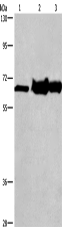 Anti-Human/Mouse/Rat CHDH Antibody - ABMIUM