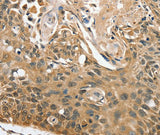 Anti-Human/Mouse RBM38 Antibody - ABMIUM
