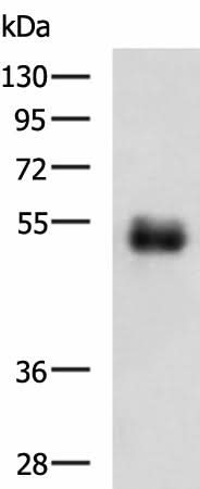 Anti-Human/Mouse METTL17 Antibody - ABMIUM