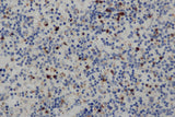 Anti-Human CD68 Antibody - ABMIUM