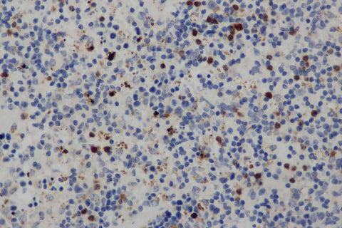 Anti-Human CD68 Antibody - ABMIUM