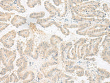 Anti-Human/Mouse EPRS Antibody - ABMIUM