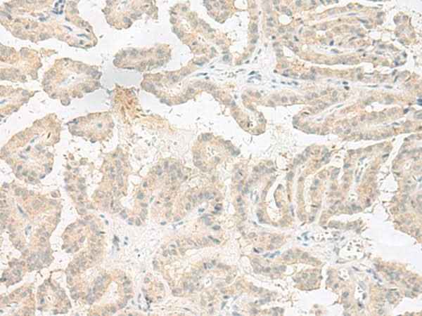 Anti-Human/Mouse EPRS Antibody