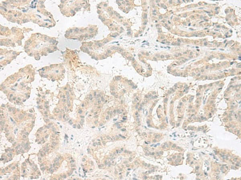 Anti-Human/Mouse EPRS Antibody - ABMIUM