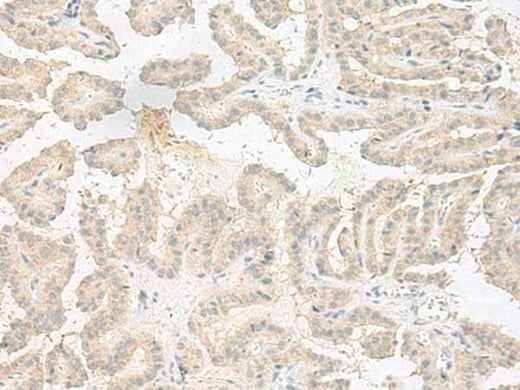 Anti-Human/Mouse EPRS Antibody - ABMIUM