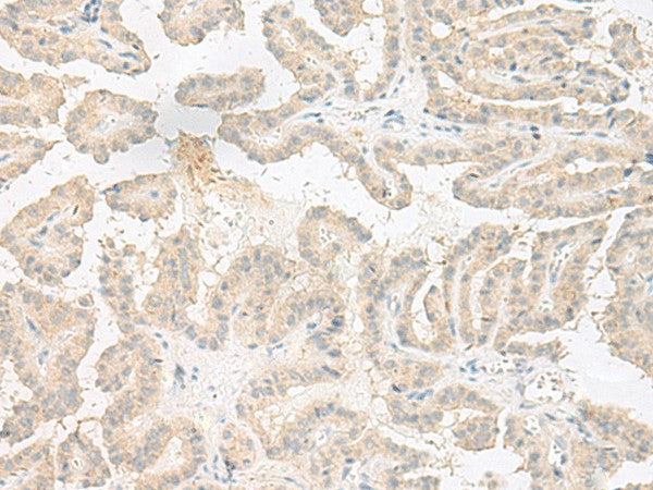Anti-Human/Mouse EPRS Antibody - ABMIUM