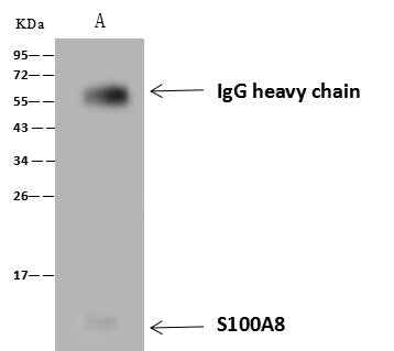 Anti-Human S100A8 Antibody [A1146] - ABMIUM