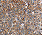 Anti-Human/Mouse PLXNA2 Antibody - ABMIUM
