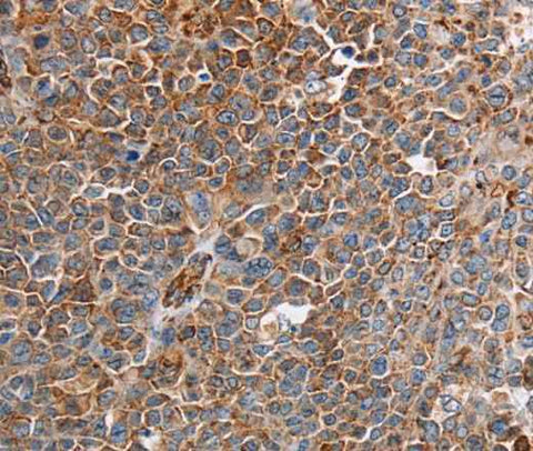 Anti-Human/Mouse PLXNA2 Antibody
