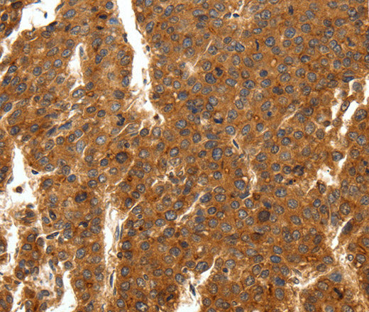 Anti-Human/Mouse/Rat SCN11A Antibody - ABMIUM