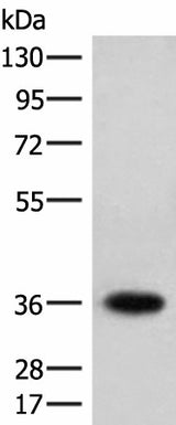 Western blot analysis of Jurkat cell lysate using HOXC12 Polyclonal Antibody at dilution of 1:500