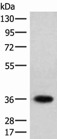 Western blot analysis of Jurkat cell lysate using HOXC12 Polyclonal Antibody at dilution of 1:500
