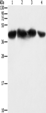 Anti-Human/Mouse/Rat PGK2 Antibody - ABMIUM