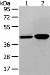 Anti-Human/Mouse VASH2 Antibody - ABMIUM