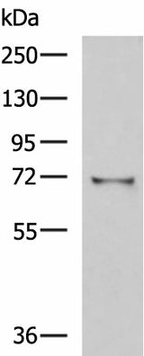 Western blot analysis of Mouse kidney tissue lysate using GSTCD Polyclonal Antibody at dilution of 1:1000