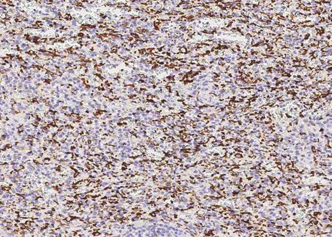 Anti-Human AIF1 Antibody [2D11] - ABMIUM