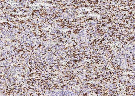 Anti-Human AIF1 Antibody [2D11] - ABMIUM