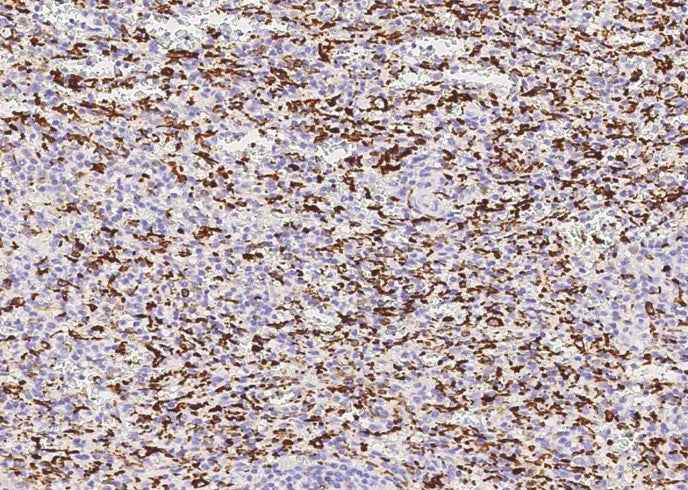 Anti-Human AIF1 Antibody [2D11]