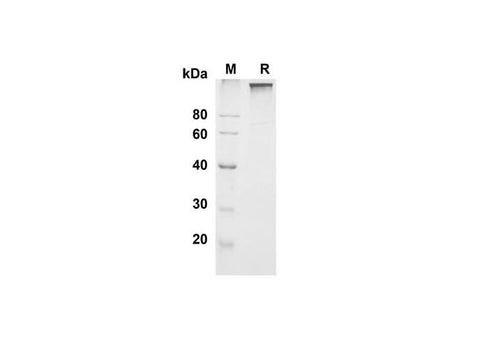 SDS-PAGE analysis of Mouse Leptin R proteins , 2 μg/lane of Recombinant Mouse Leptin R proteins was resolved with SDS-PAGE under reducing conditions , showing bands at 115-125 kDa.