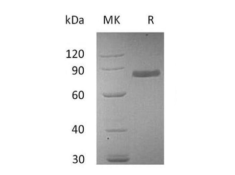 Recombinant Human Transferrin Protein (His Tag) - ABMIUM