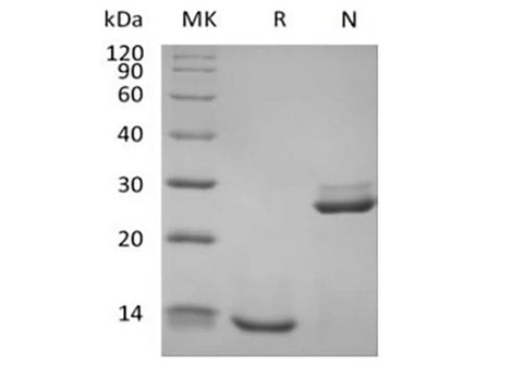 Recombinant Human Transforming Growth Factor Beta-1/TGFB1 Biotinylated - ABMIUM