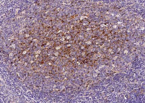 Anti-Human CD200 Antibody [B127] - ABMIUM