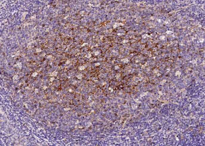 Anti-Human CD200 Antibody [B127]