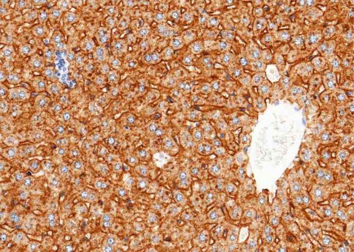 Anti-Mouse ASGR1 Antibody [B395] - ABMIUM