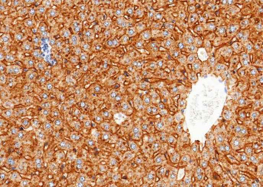 Anti-Mouse ASGR1 Antibody [B395] - ABMIUM