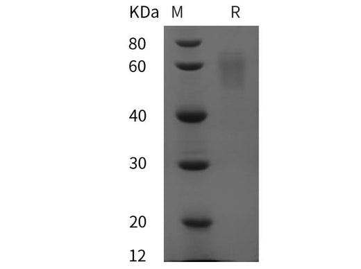 SDS-PAGE analysis of Human SerpinA6/CBG proteins, 2 μg/lane of Recombinant Human SerpinA6/CBG proteins was resolved with SDS-PAGE under reducing conditions, showing bands at 60 kDa.