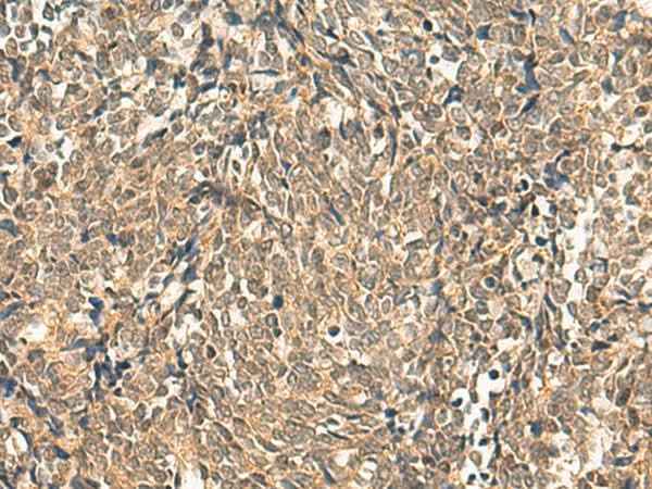 Anti-Human/Mouse/Rat HNF1A Antibody