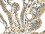 Anti-Human/Mouse STK35 Antibody - ABMIUM