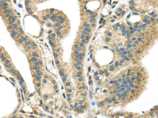 Anti-Human/Mouse STK35 Antibody