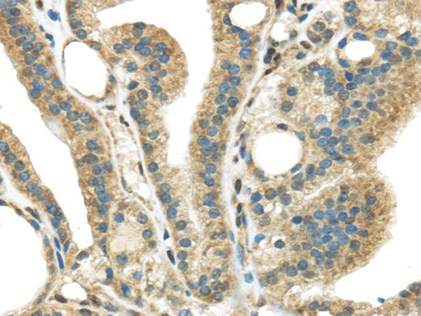 Anti-Human/Mouse STK35 Antibody - ABMIUM