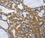 Anti-Human/Mouse PIAS2 Antibody - ABMIUM