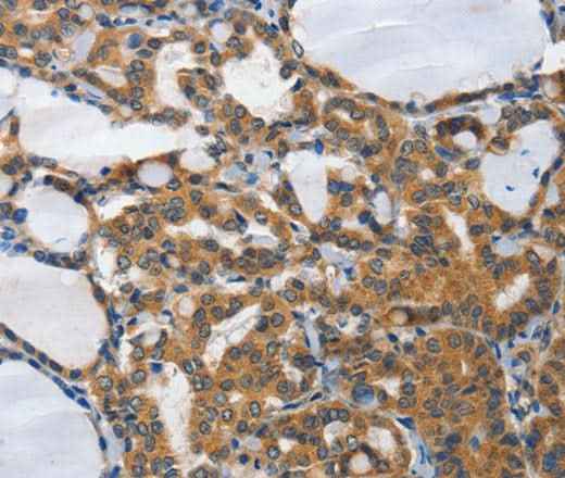 Anti-Human/Mouse PIAS2 Antibody