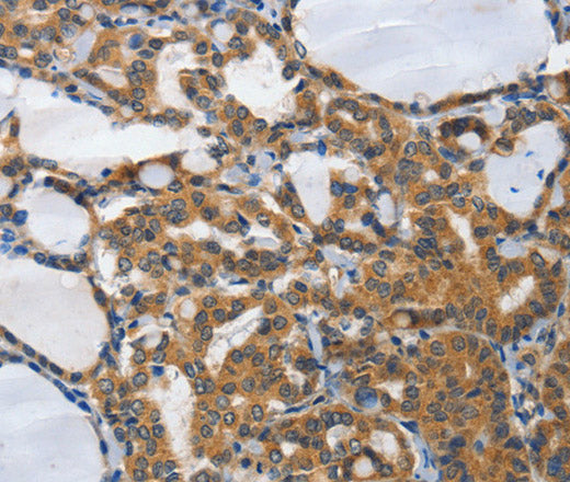 Anti-Human/Mouse PIAS2 Antibody - ABMIUM