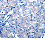 Anti-Human CCL2 Antibody - ABMIUM