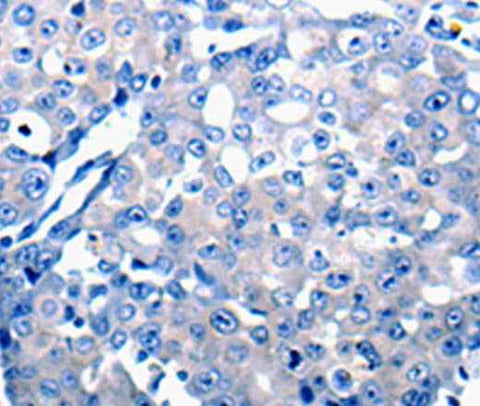 Anti-Human CCL2 Antibody